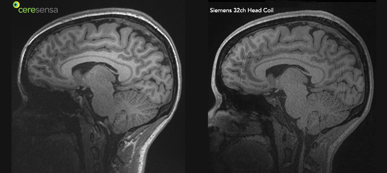 Anatomical Scan Comparison