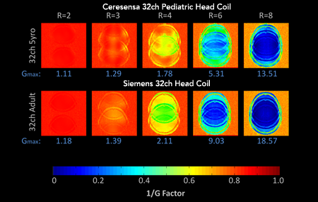 Noise Amplification Comparison 1D