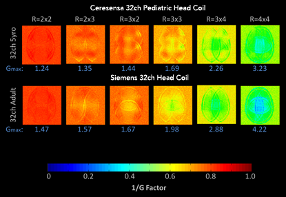 Noise Amplification Comparison 2D