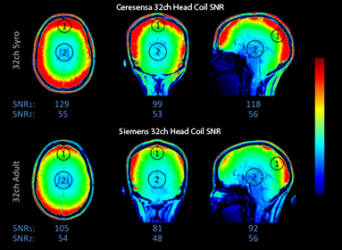 Ceresensa Head resonator Anatomical Scan